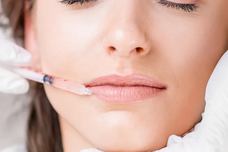 Preventative Botox in San Jose: Is Starting in Your 20s or 30s Worth It?